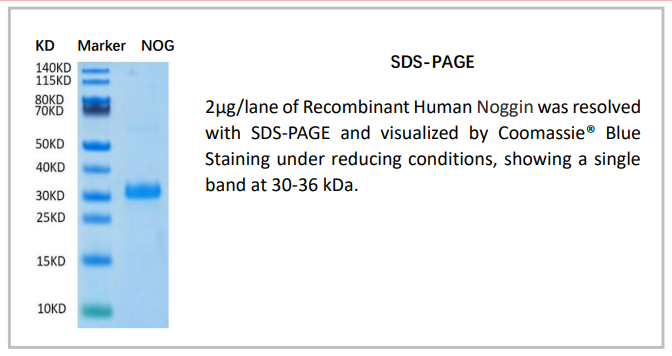 OrganRegen-Recombinant Human Noggin（807-NOG）.png